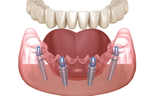 ATAMNABUJARAN - ATAMNABUJRANNER - STOMATOLOGIAKAN KLINIKA