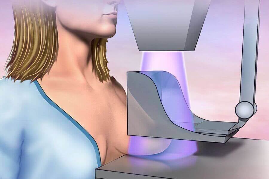 ՄԱՄՈԳՐԱՖԻԱ / ՈՒ՞Մ Է ՊԵՏՔ ՄԱՄՈԳՐԱՖԻԱՆ / Ի՞ՆՉ Է ՄԱՄՈԳՐԱՖԻԱՆ - MAMOGRAFIA