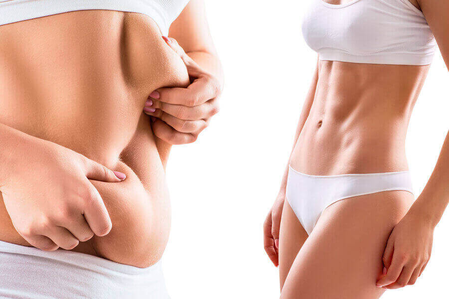 ԼԻՊՈՍԱԿՑԻԱ ԹԵ՞ ԿՐԻՈԼԻՊՈԼԻԶ / ԼԻՊՈՍԱԿՑԻԱՅԻ ԵՎ ԿՐԻՈԼԻՊՈԼԻԶԻ ՀԱՄԵՄԱՏՈՒԹՅՈՒՆ - LIPOSAKCIA - KRIOLIPOLIZ