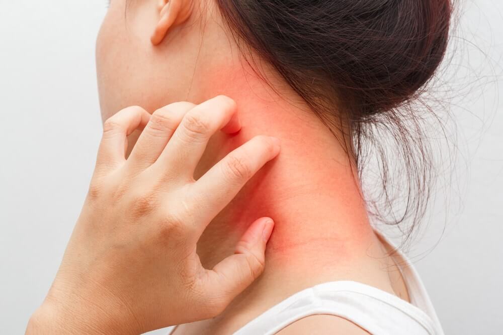 ԷԿԶԵՄԱ / ԷԿԶԵՄԱՅԻ ՊԱՏՃԱՌՆԵՐԸ, ՍԻՄՊՏՈՄՆԵՐԸ ԵՎ ԲՈՒԺՈՒՄԸ - EKZEMA