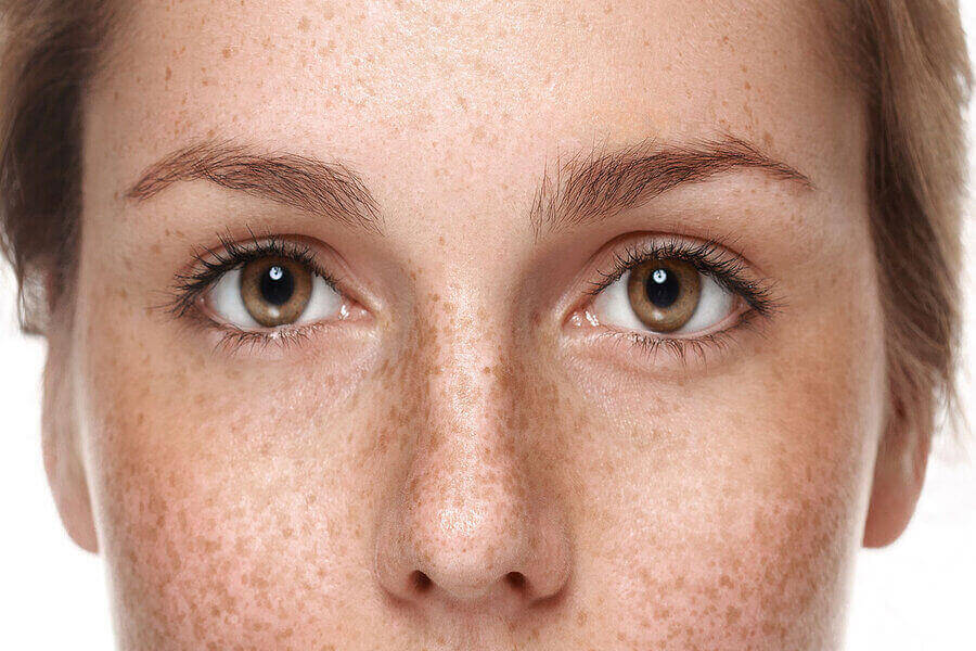 ՊԻԳՄԵՆՏԱՅԻՆ ԲԾԵՐ / ԴԵՄՔԻ ՊԻԳՄԵՆՏԱՑԻԱՅԻ ( ՊԻԳՄԵՆՏԱՅԻՆ ԲԾԵՐԻ ) ՀԵՌԱՑՄԱՆ ՄԵԹՈԴՆԵՐԸ