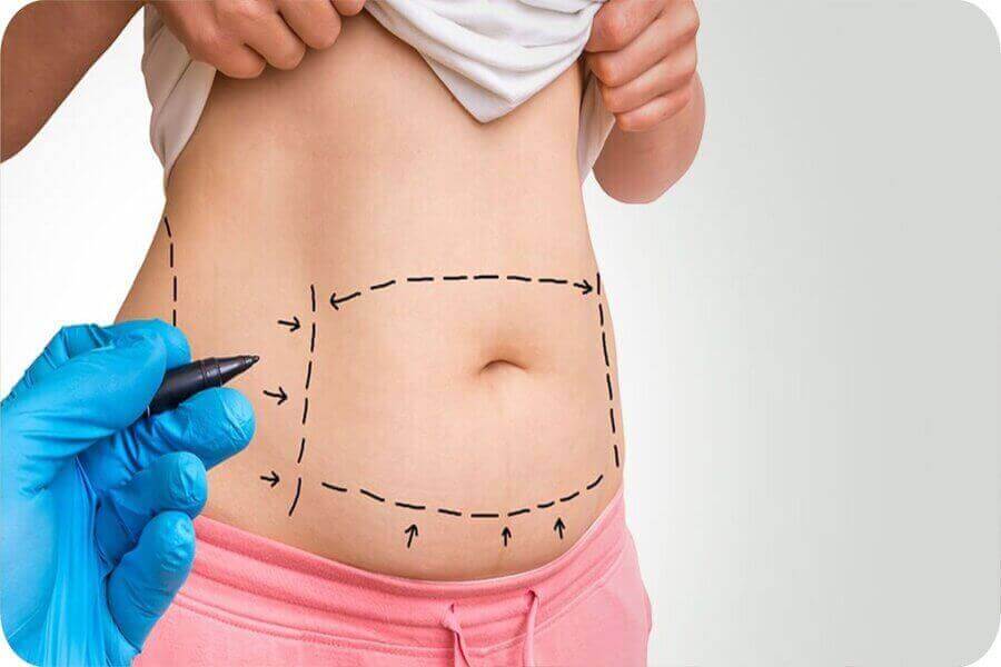 ԱԲԴՈՄԻՆՈՊԼԱՍՏԻԿԱ - ՊԼԱՍՏԻԿ ՎԻՐԱԲՈՒԺՈՒԹՅՈՒՆ - ՊԼԱՍՏԿ ՎԻՐԱԲՈՒԺՈՒԹՅԱՆ ԿԵՆՏՐՈՆ