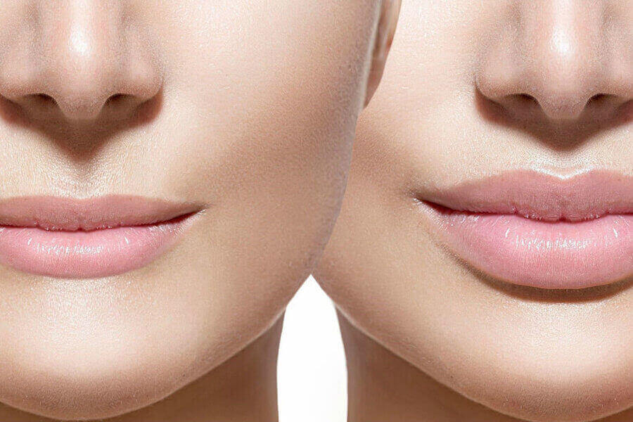 ՇՈՒՐԹԵՐԻ ՄԵԾԱՑՈՒՄ