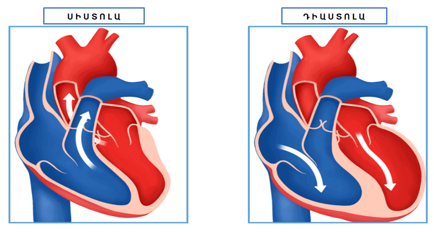 ՍԻՍՏՈԼԱ - ԴԻԱՍՏՈԼԱ - ՍՐՏԻ ԱՆԲԱՎԱՐԱՐՎԱԾՈՒԹՅՈՒՆ - ՍԻՐՏ ԱՆՈԹԱՅԻՆ ՀԻՎԱՆԴՈՒԹՅՈՒՆՆԵՐ - ԲՈՒԺՈՒՄ - SISTOLA - DIASTOLA - SIRT