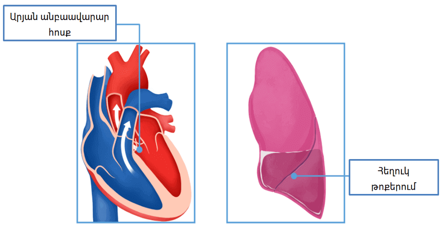 ՍՐՏԱՅԻՆ ԱՆԲԱՎԱՐԱՐՈՒԹՅՈՒՆ - ՍՐՏԻ ԱՆԲԱՎԱՐԱՎԱԾՈՒԹՅԱՆ ԲՈՒԺՈՒՄ - ԱԽՏԱՆԻՇՆԵՐ - ՍԻՐՏ - SIRT - ՍՐՏԻ ԲՈՒԺՄԱՆ ԿԵՆՏՐՈՆ - ԿԼԻՆԻԿԱ