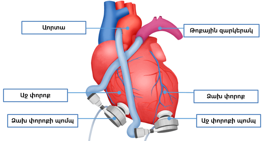 ՍՐՏԻ ԿԱՌՈՒՑՎԱԾՔԸ - ՍՐՏԱՅԻՆ ԱՆԲԱՎԱՐԱՐՈՒԹՅՈՒՆ - ՍԻՐՏ-ԱՆՈԹԱՅԻՆ ՀԻՎԱՆԴՈՒԹՅՈՒՆՆԵՐ - ՍԻՐՏ - SIRT