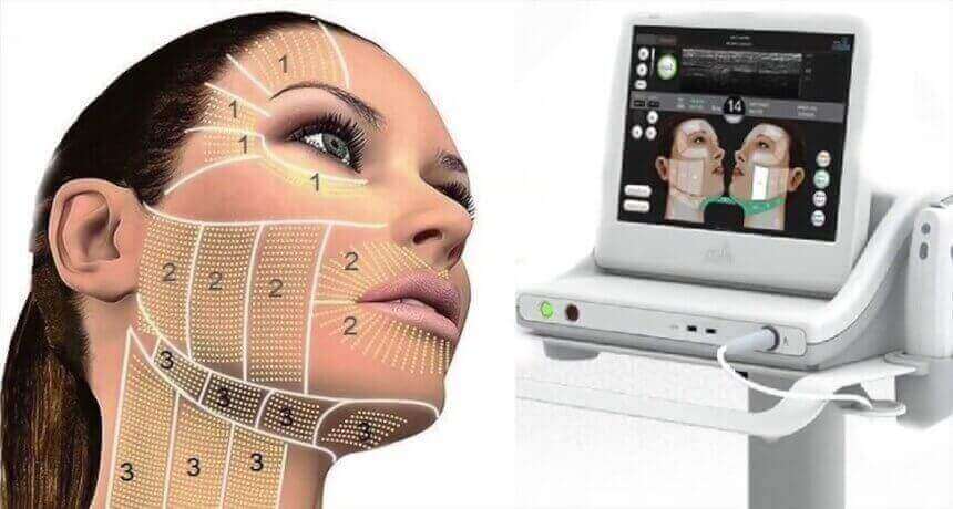 HIFU SMAS ԼԻՖՏԻՆԳ - ЛИФТИНГ - HIFU SMAS LIFTING - ԵՐԻՏԱՍԱՐԴԱՑՈՒՄ