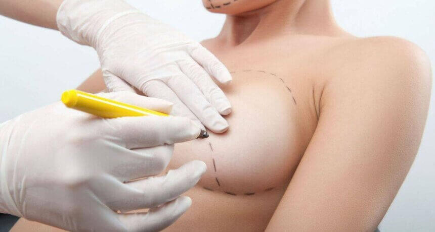 ՄԱՄՈՊԼԱՍՏԻԿԱ ( ԿՐԾՔԻ ՊԼԱՍՏԻԿ ՎԻՐԱՀԱՏՈՒԹՅՈՒՆ ) - ՊԼԱՍՏԻԿ ՎԻՐԱԲՈՒԺՈՒԹՅՈՒՆ - ՊԼԱՍՏԻԿԱ -