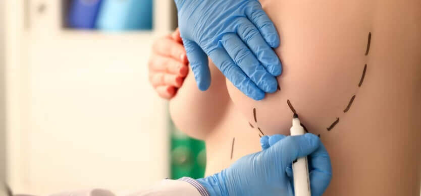 ՄԱՄՈՊԼԱՍՏԻԿԱ ( ԿՐԾՔԻ ՊԼԱՍՏԻԿ ՎԻՐԱՀԱՏՈՒԹՅՈՒՆ ) - ՊԼԱՍՏԻԿԱ - ՊԼԱՍՏԻԿ ՎԻՐԱԲՈՒԺՈՒԹՅՈՒՆ - ՊԼԱՍՏԻԿ ՎԻՐԱՀԱՏՈՒԹՅՈՒՆ - ԿՈՒՐԾՔ - PLASTIKA - KRCQERI PLSTIKA