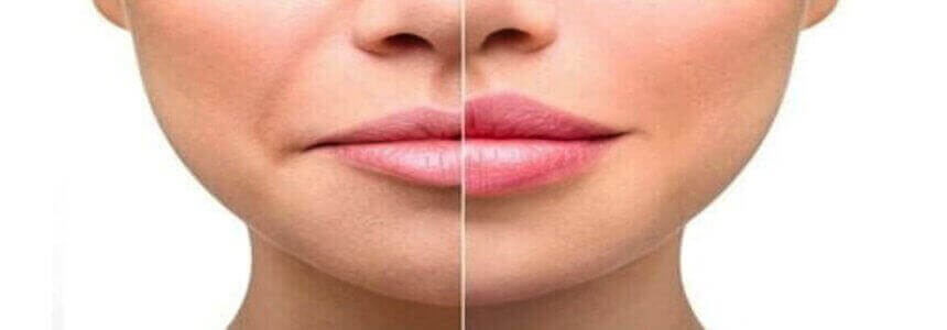 ԿՈՆՏՈՒՐԱՅԻՆ ՊԼԱՍՏԻԿԱ ( ՈՒՐՎԱԳԾԱՅԻՆ ՊԼԱՍՏԻԿԱ ) ՈՒՐՎԱԳԾԱՅԻՆ ՊԼԱՍՏԻԿԱՅԻ ԿԵՆՏՐՈՆՆԵՐ ( ԾԱՌԱՅՈՒԹՅՈՒՆՆԵՐ )