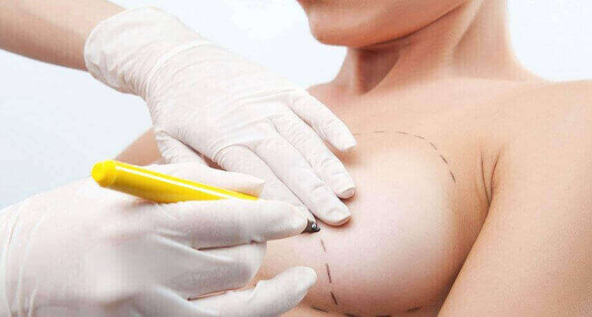 ՄԱՔՍՏՈՊԵՔՍԻԱ ԿՐԾՔԻ ՁԳՈՒՄ ( ԼԻՖՏԻՆԳ ) ՊԼԱՍՏԻԿ ՎԻՐԱԲՈՒԺՈՒԹՅՈՒՆ - ԿՐԾՔԵՐԻ ԲԱՐՁՐԱՑՈՒՄ - ՊԼԱՍՏԻԿ ՎԻՐԱԲՈՒԺՈՒԹՅԱՆ ԿԵՆՏՐՈՆՆԵՐ