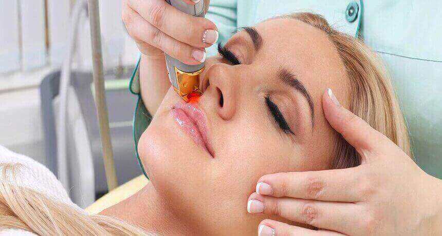 ԴԵՄՔԻ ԼԱԶԵՐԱՅԻՆ ՄԱԶԱՀԵՌԱՑՈՒՄ ( ԷՊԻԼՅԱՑԻԱ )