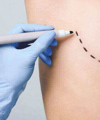 ԿՐԾՔԵՐԻ ՁԳՈՒՄ ( ԼԻՖՏԻՆԳ ) / ՀԱՐՑ ՈՒ ՊԱՏԱՍԽԱՆ ԿՐԾՔԵՐԻ ԼԻՖՏԻՆԳԻ ՊԼԱՍՏԻԿ ՎԻՐԱԲՈՒԺՈՒԹՅԱՆ ՎԵՐԱԲԵՐՅԱԼ