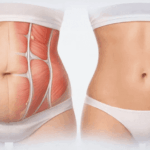 ԱԲԴՈՄԻՆՈՊԼԱՍՏԻԿԱ